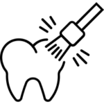 Laser teeth whitening