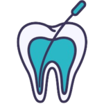 Root Canal Treatment