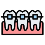 Braces/Orthodontics Treatment