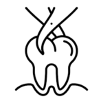 TOOTH EXTRACTION