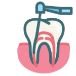 2. Root Canal Procedure